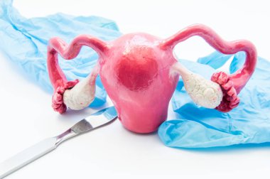Kadın hastalıkları cerrahisi kavramı. kadın rahim 3D model neşter ve Medikal Ürünler yakındır. Böyle bir histerektomi ya da myomektomi ameliyatı kadın hastalıkları ve işlem rahim, yumurtalık veya fallop tüpleri 