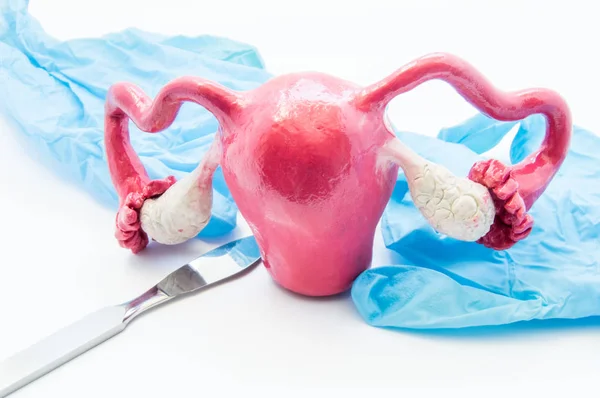 Concept de chirurgie gynécologique. Le modèle 3D de l'utérus féminin est proche du scalpel et des gants médicaux. Chirurgie gynécologique et intervention sur utérus, ovaires ou trompes de Fallope telle qu'hystérectomie ou myomectomie — Photo