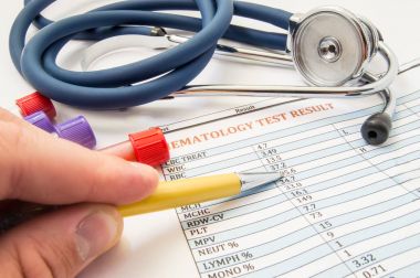 Hematoloji vasıl iş kavramı fotoğraf. Hematoloji doktor kan ve stetoskop Onkoloji dahil olmak üzere kan hastalıkları tanısında ile işyeri test tüpleri yakınındaki yatıyor hasta kan analizi bakar
