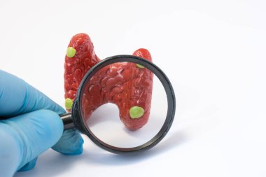 Arama hastalığı, anormallikler veya patoloji Paratiroid bezleri konsept fotoğraf. Holding Büyüteç doktor ve içinden modeli Paratiroid bezlerinin hastalığı için tanılama iletken inceliyor