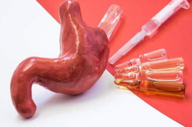 Sahne, tedavi, tedavi veya mide - akut ve kronik hastalıklara karşı aşı. Anatomik model mide veya mide şişeleri ve şırınga ilaç kırmızı arka plan ile karşısında yer alır