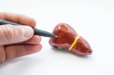 Olası yerelleştirme ağrı veya karaciğer sorunu. Doktor ya da öğretmen Tıp Üniversitesi veya okul Puan anatomik konuma acı karaciğer, 3d modeli. Hepatik teşhis konsepti