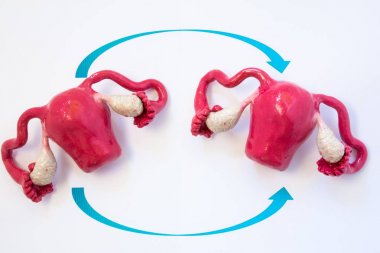 Uterus transplantation concept photo. Two anatomical models of uterus with ovaries with two arrows crossing over each other, symbolizing transplantation of human organs of female reproductive system clipart