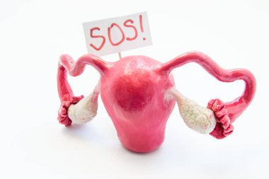Doğal anatomik 3d rahim ile yumurtalık modeli ile afişini inscripted Sos hasta ya da doktor yardım için atıfta. Tüm belirtiler, sendromlar, hastalıklar ve dişi organların patolojiler için gebe
