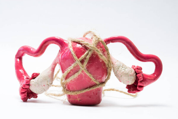 Concept photo of uterus menstrual cramps, pain and painful menstruation (dysmenorrhea). Rope tightens around model of uterus with ovaries, symbolizing spasm, pain that occurs when painful menstruation