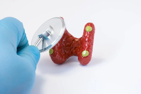 Main du médecin en gant avec stéthoscope et forme 3D de la glande parathyroïde. Idée de photos où le chirurgien ou le médecin généraliste effectue le diagnostic préopératoire ou le diagnostic de la maladie parathyroïde — Photo