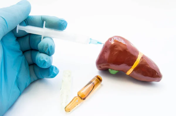 Doctor conducts liver treatment or detox by injecting medication using syringe in 3D model of organ. Concept photo symbolizing process of treatment of liver diseases - hepatitis C, cirrhosis, alcohol — Stock Photo, Image