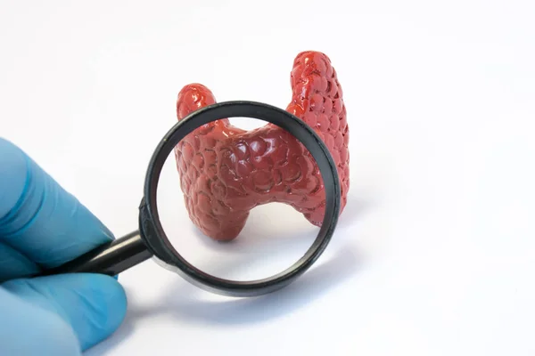 Search disease, abnormalities or pathology of thyroid gland concept photo. Doctor holding  magnifying glass and through it examines of model of thyroid gland, conducting diagnostics for disease — Stock Photo, Image