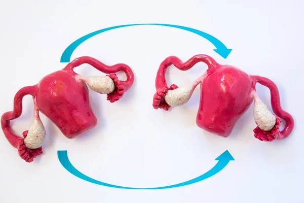 Foto concettuale del trapianto di utero. Due modelli anatomici di utero con ovaie con due frecce che si incrociano, simboleggiando il trapianto di organi umani del sistema riproduttivo femminile — Foto Stock