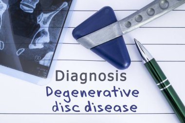 Tanı dejeneratif disk hastalığı. Tıbbi sağlık geçmişi Lomber disk hastalığı, MRI görüntü sakral omurga ve nörolojik çekiç tanısı ile yazılmış. Nöroloji, nörolojik için tıbbi kavramı