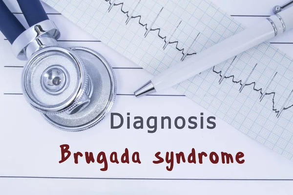 Діагностувати синдром Брюггади. Стетоскоп або фонендоскоп разом з типом ЕКГ лежать на медичній історії з діагнозом синдрому Брюггади. Медична концепція кардіології та внутрішньої медицини — стокове фото