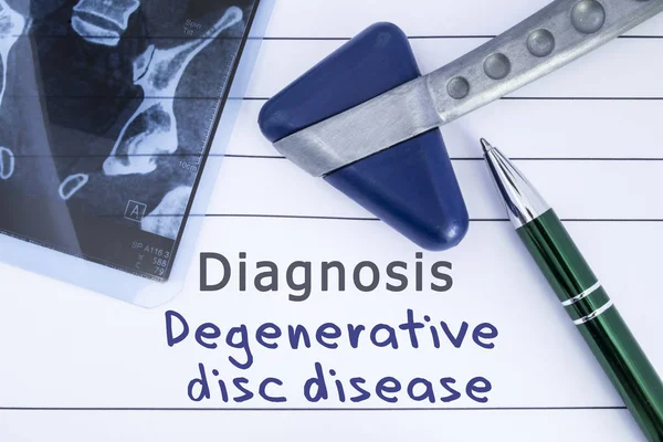 Diagnosis degenerative disc disease. Medical health history written with diagnosis of Lumbar disc disease, MRI image sacral spine and neurological hammer. Medical concept for Neurology, Neuroscience — Stock Photo, Image