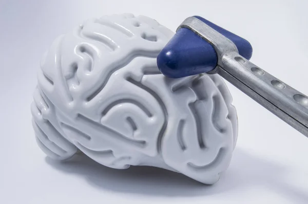 Неврологический молоток Блу лежал на пластиковой фигуре человеческого мозга с четкими свёртками. Идея образа для неврологической диагностики, неврологии или неврологии — стоковое фото
