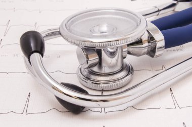 Phonendoscope ve stetoskop krom binaural parçalar ve mavi esnek boru ile yatıyor Elektrokardiyogram (Ekg veya EKG) büyük göğüs parçası üzerinde yukarı doğru