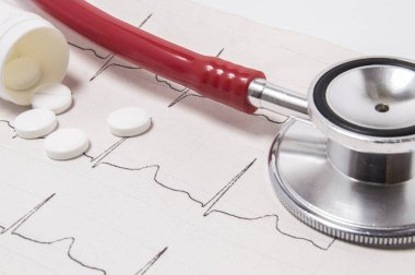 An open plastic container for tablets, which spilled white pills on a printed  electrocardiogram as a background and a stethoscope lying on a doctor's table close up. Concept for cardiology clipart