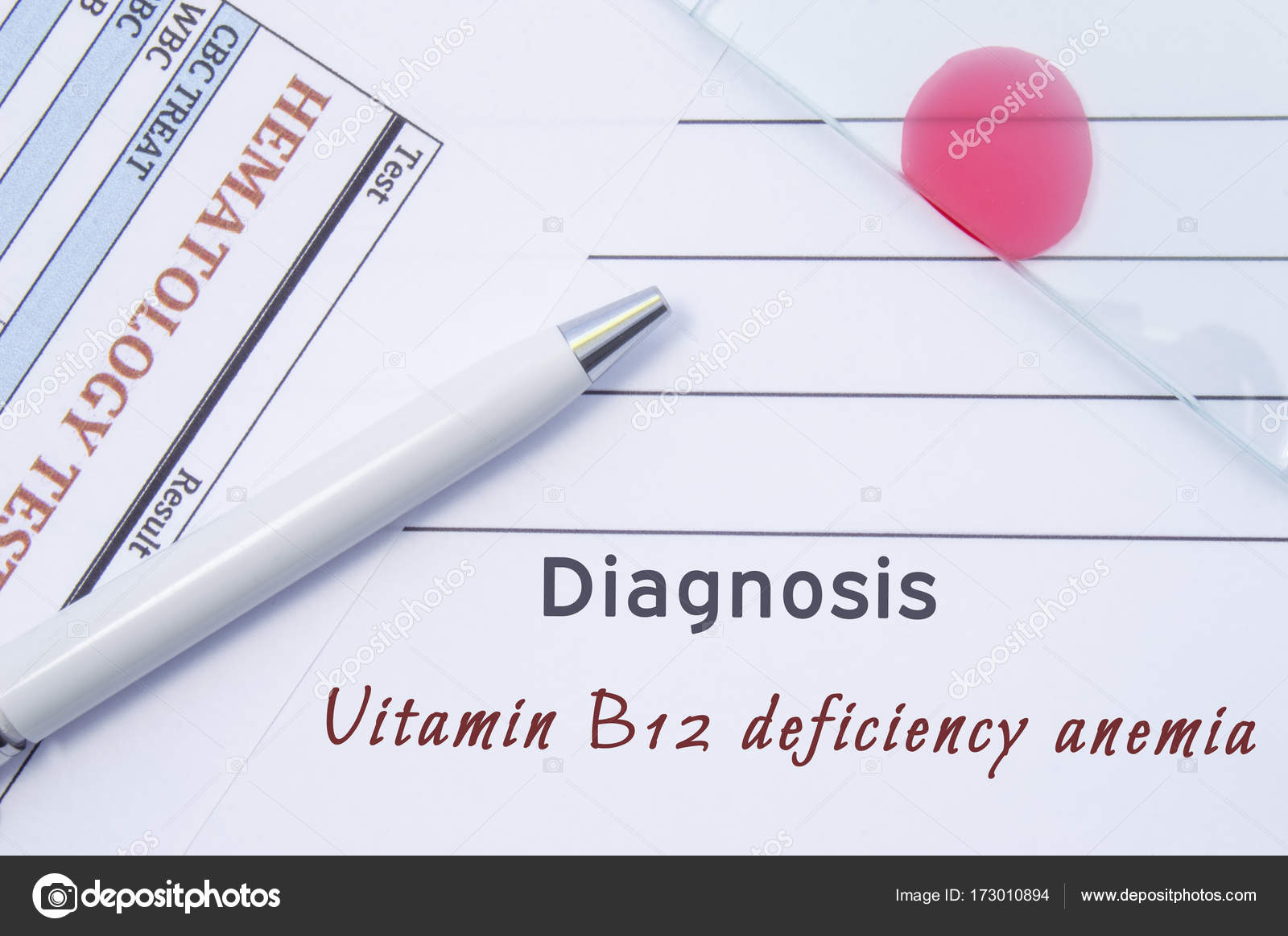 Diagnosis Vitamin B12 Deficiency Anemia Written By Doctor