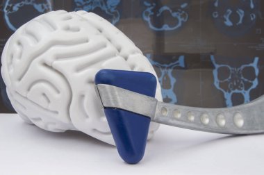 İnsan beyni ile spiral Bilgisayarlı Tomografi (Sct) veya manyetik rezonans tomografisi (Mrt) resmi bir arka plan üzerinde nörolojik çekiç figürü kapatın. Nöroloji Tanı için fikir 