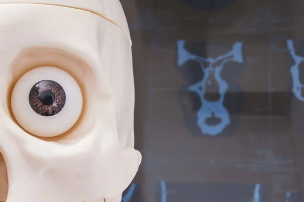 目のソケットとらせん状コンピューター断層撮影法 (Sct) または磁気共鳴断層レントゲン写真撮影 (Mrt) 画像の背景にある目人間の頭蓋骨の姿をクローズ アップ。眼科で診断のためのアイデア — ストック写真