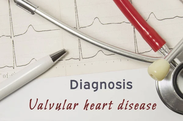 Cardiac diagnosis of Valvular Heart Disease. On doctor workplace is paper medical documentation, which indicated diagnosis of Valvular Heart Disease, surrounded by red stethoscope, ECG line close-up