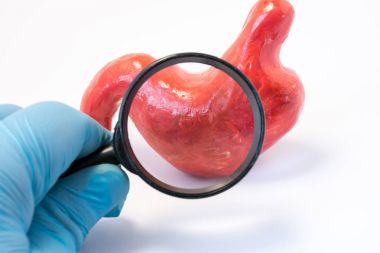 Arama hastalığı, anormallikler veya patoloji mide veya mide kavramı fotoğraf. Holding Büyüteç doktor ve içinden bir modeli mide ya da oniki parmak bağırsağı, tanılama hastalığı için iletken inceliyor