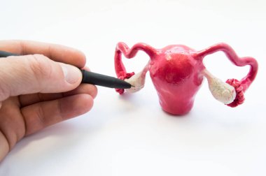 Doctor or teacher points of ballpoint pen on ovaries on anatomical model of internal female sex organs. Ovaries organ where eggs are produced, male and female hormones, as well as different diseases clipart
