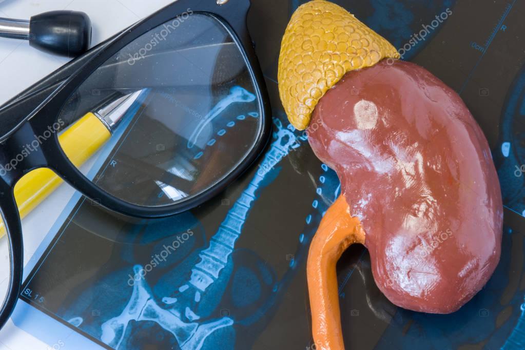 MRI resonance imaging) of kidney and adrenal glands. Model of