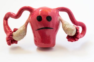 Concept photo of unhappy, sad uterus and ovaries with sickness or disorder. Figure of uterus with sad smile. clipart