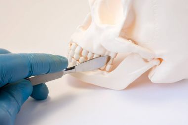 Dental, oral and maxillofacial surgery concept photo. Gloved surgeon hand with scalpel is near teeth of lower and upper jaw, symbolizing dental surgery or intervention in oral or maxillofacial area  clipart