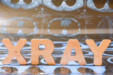 X-ışınları tıpta tanı bir yordam. Word x-ışını üç boyutlu harflerin oluşur, bu portre için ön plan ve grafisi veya arka planda bulanık Ct üzerinde duruyor