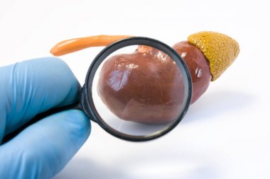 Arama hastalığı, anormallikler veya böbrek konsept fotoğraf patolojisi. Holding doktor büyütme cam ve böbrek, teşhis için hastalık kanser, nefropati, taş gibi iletken modelini inceliyor
