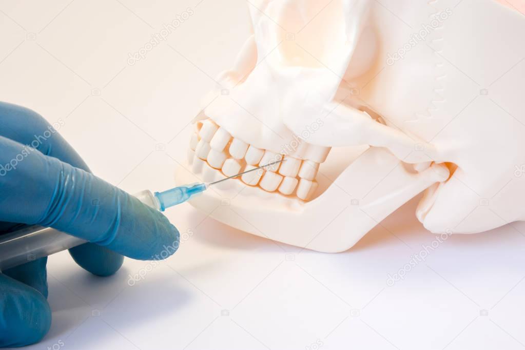 Dental anesthesia or puncture cyst tooth concept photo. Doctor dentist holding syringe, needle stabs into upper jaw of skull above the teeth, pursuing dental anesthesia procedure, cyst puncture