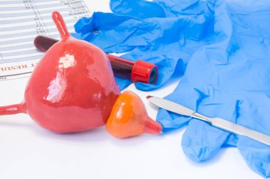 Prostat ve idrar kesesi Üroloji cerrahi kavramı. Mesane ile prostat neşter, cerrahi eldiven ve kan testi tüp kan sonucu ile yakın değildir. Cerrahi veya cerrahi operasyon endikasyonları