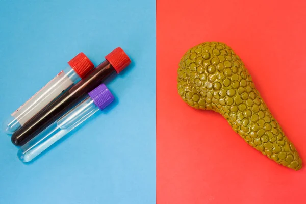 实验室诊断的代谢功能 生化侵犯 胰腺损伤 在红色和蓝色的背景下 胰腺和实验室试管相互对立 — 图库照片