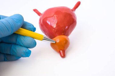 Doktor ya da tükenmez kalemle anatomik modeli bir mesane ile prostat prostat bezi işaret eden öğretmen. Çalışma anatomi işlevi bezi veya hasta için bir gösterge olduğunu tespit edilen prostat patoloji