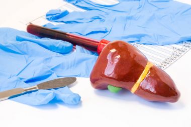 Karaciğer ve safra kesesi safra ameliyatı kavramı. Karaciğer safra kesesi ile neşter, cerrahi eldiven ve kan testi tüp kan sonucu ile yakın değildir. Cerrahi ve Cerrahi operasyon endikasyonları