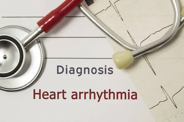 Cardiac diagnosis of Heart Arrhythmia. On doctor workplace are red stethoscope, printed on paper ECG line and a pen close-up lying on medical handbook, which indicated diagnosis of Heart Arrhythmia