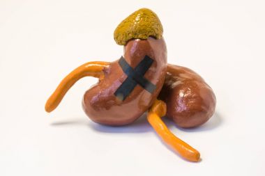 Böbrek ve böbrek üstü bezleri anatomik model onlara büyük bir siyah haç kopyaladım. Belirten başarısızlık böbrek işlev veya adrenal hormon yetmezliği, organ ölüm, ölümcül hastalık kavramı fotoğraf