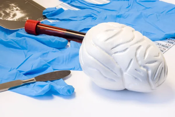 Brain Nervous Surgery Neurosurgery Concept Model Brain Scalpel Ultrasound Result — Stock Photo, Image