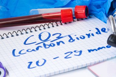 Serumu veya temel metabolik test kanda CO2 veya karbon dioksit. Laboratuvar test tüpleri ile kan yayma, stetoskop veya film ve eldiven metin karbon dioksit doktor ofiste tabloda notla yakındır