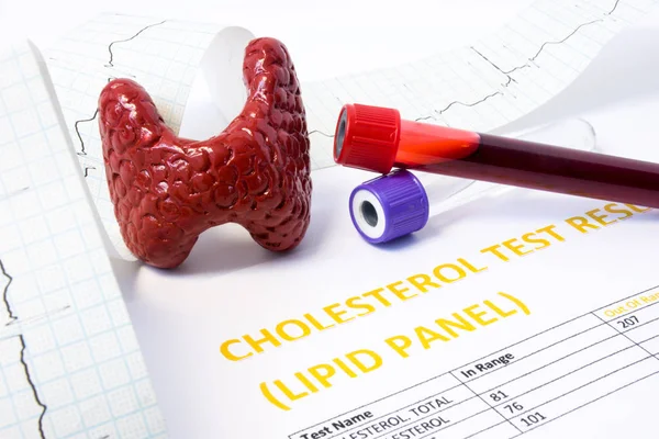 Schildklier Cholesterol Concept Foto Model Van Schildklier Reageerbuisjes Met Bloed — Stockfoto