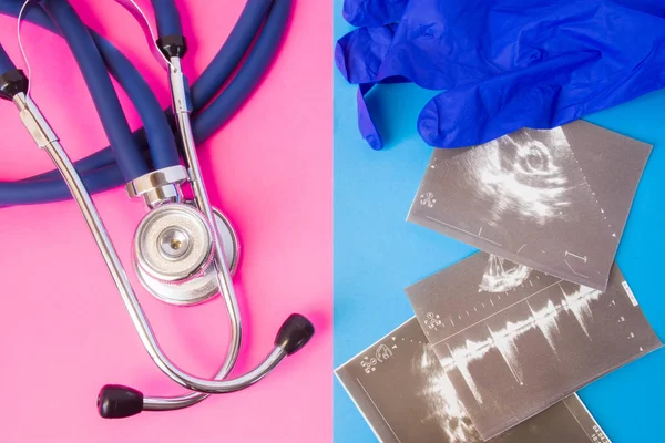 Ultrasound images and medical stethoscope in two colors background: blue and pink. Concept of preparation or completion of ultrasound examination procedure in men and women, detection of diseases — Stock Image Ultrasound Images Medical Stethoscope Two Colors Background Blue Pink Concept Royalty Free Stock Images