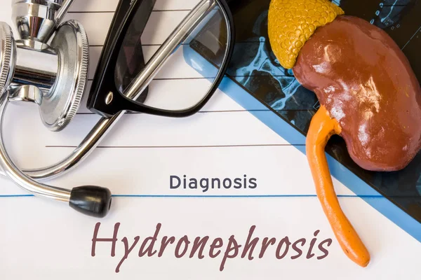 Diagnose Hydronephrose Foto Die Figur Der Niere Liegt Neben Der — Stockfoto