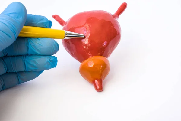 Doctor or teacher with ballpoint pen pointing on bladder on anatomical model of urine bladder with prostate. Study anatomy of urinary system or indication for patient to place of detected pathology — Stock Image Doctor Teacher Ballpoint Pen Pointing Bladder Anatomical Model Urine Bladder Royalty Free Stock Images