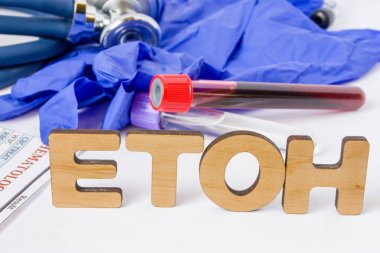 Alkol kısaltma veya kısaltma için laboratuvar testi veya tanılama etanol, insan kan alkol, alkol kötüye veya alkolizm para çekme. Word alkol laboratuvar test tüplerini kan ve stetoskop ortasında 
