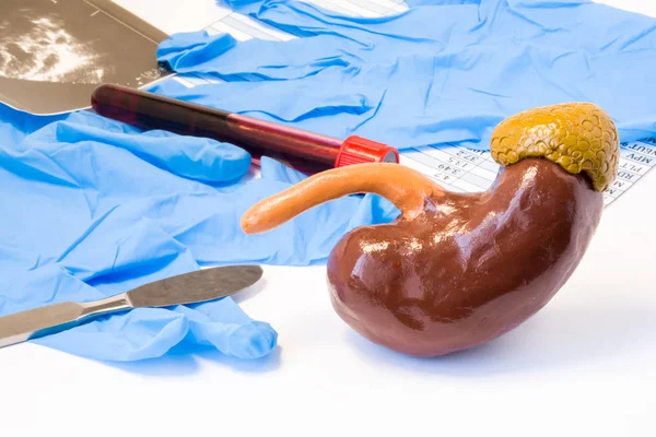 Kidney Adrenal Gland Urology Surgery Concept Model Kidneys Adrenal Gland — Stock Photo, Image