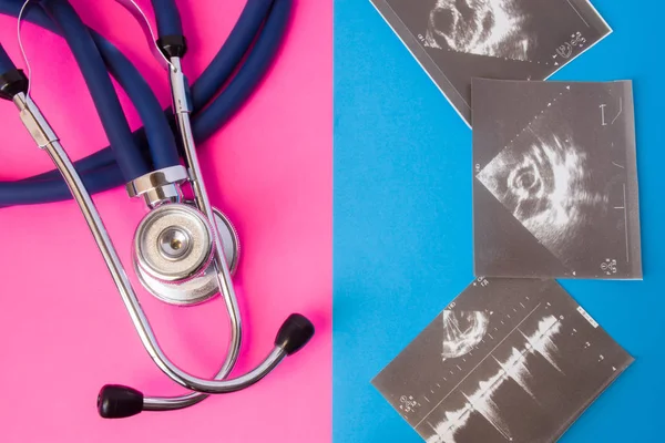 超音波検査または検査医療聴診器 色背景での架空 青とピンク 男性と女性 病気や障害の検知に超音波テスト スキャンの概念 — ストック写真
