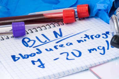 Topuz veya kan üre nitrojen laboratuvar temel metabolik test. Not Metin Bun doktor ofiste tabloda ile laboratuvar test tüplerini kan, stetoskop, karalama veya film ve eldiven yakındır