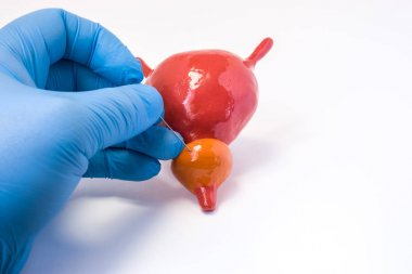 Prostat bezi doku biyopsisi yordamı. Holding ürolog iğne ve vücut ponksiyon yapar anatomik prostat organ. Tanılama Tanılama işlemler için prostat doku örnekleri alma