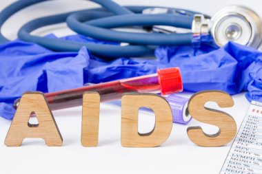 Kısaltma veya kısaltma kazanılmış bağışıklık yetmezliği sendromu - insan immün yetmezlik virüsü (HIV) tarafından neden olduğu enfeksiyon yardımcı olur. Laboratuvar tüp kan örneği, eldiven arka plan ile ön plan Word AIDS açıktır