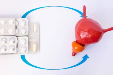 Kabarcıklar tablet veya hap okları prostat ve mesane, anatomik modeli ile gösterilen yığını. Tedavi, ikame tedavisi prostat hastalıkları ve Üroloji hastalık kavramı fotoğraf